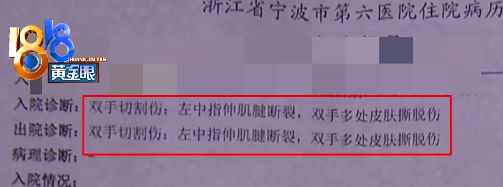 “小张被浴室玻璃门割伤手”上了热搜第一！网友：长太帅影响我看新闻半岛官网(图1)